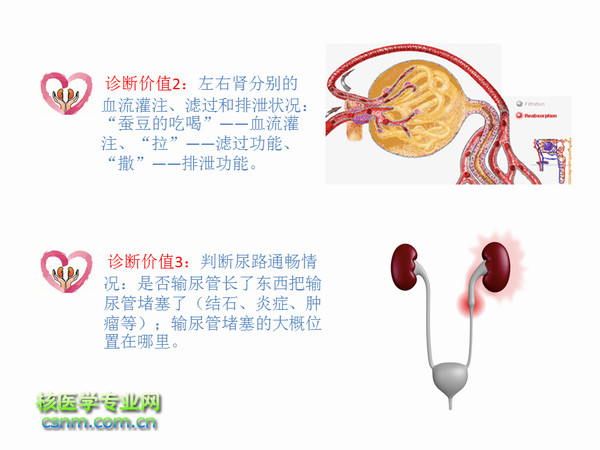 肾动态显像的原理是什么_肾动态显像报告单