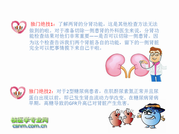 肾动态显像的原理是什么_肾动态显像报告单