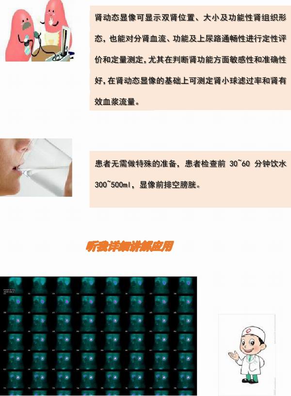肾动态显像的原理是什么_肾动态显像报告单