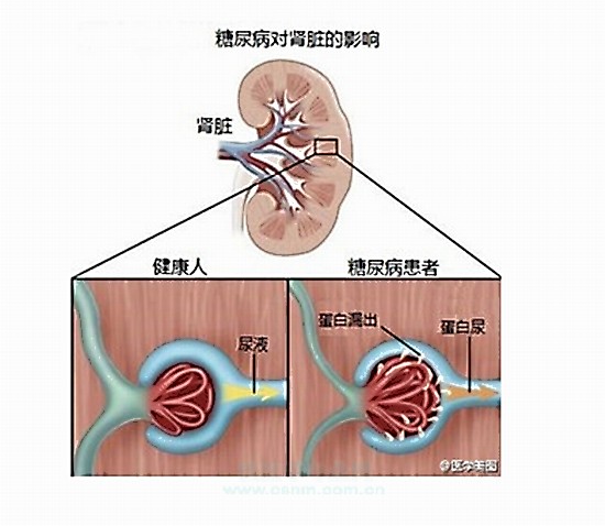 肾动态显像的原理是什么_肾动态显像报告单(2)