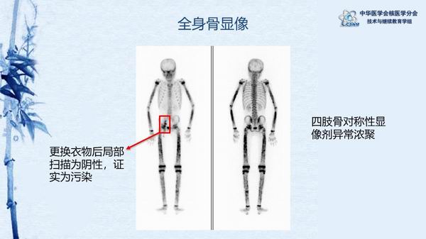 调整大小 bc66d97b0cf3440b9aba60ca2bb512ef.jpg