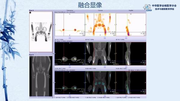 调整大小 1564561bdb8d4f088d3fd6276d61189f.jpg